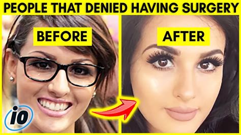 sssniperwolf before after|Sssniperwolf 